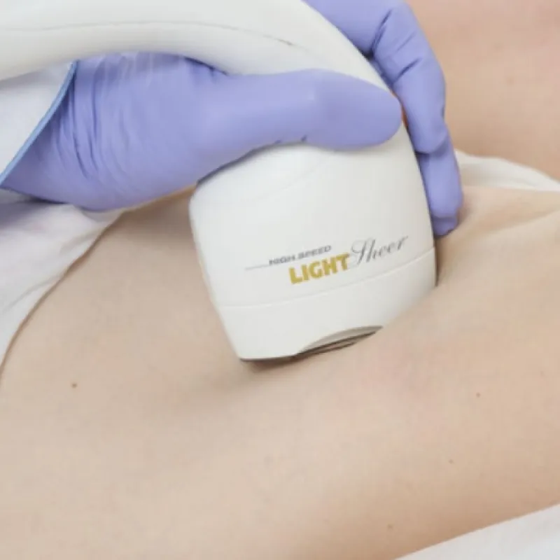 aluguel de aparelhos de depilação a laser