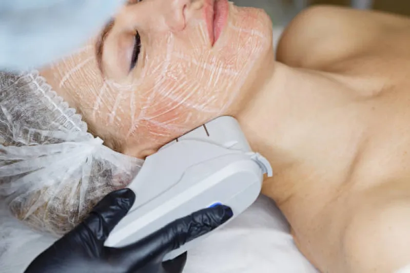 aparelho de estética ultraformer 3