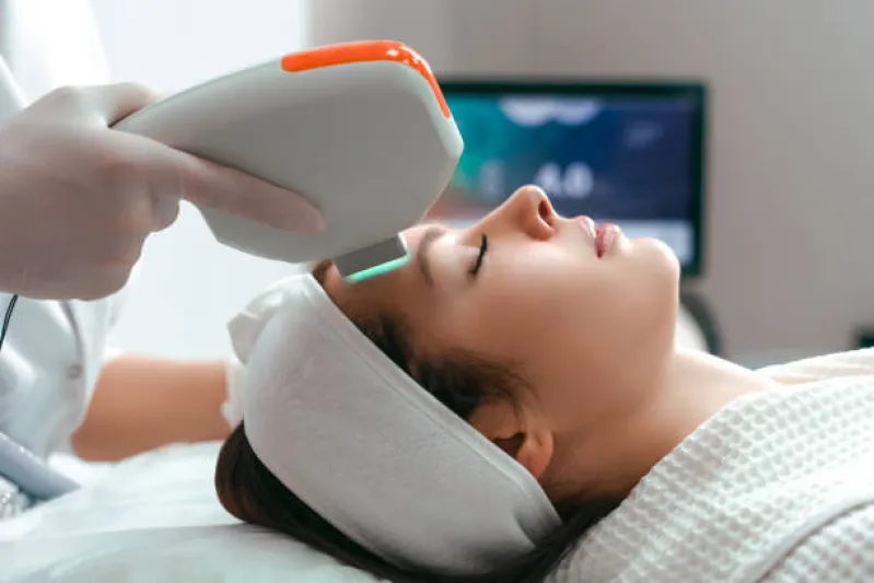 locação máquina de ultrassom herus hifu mg