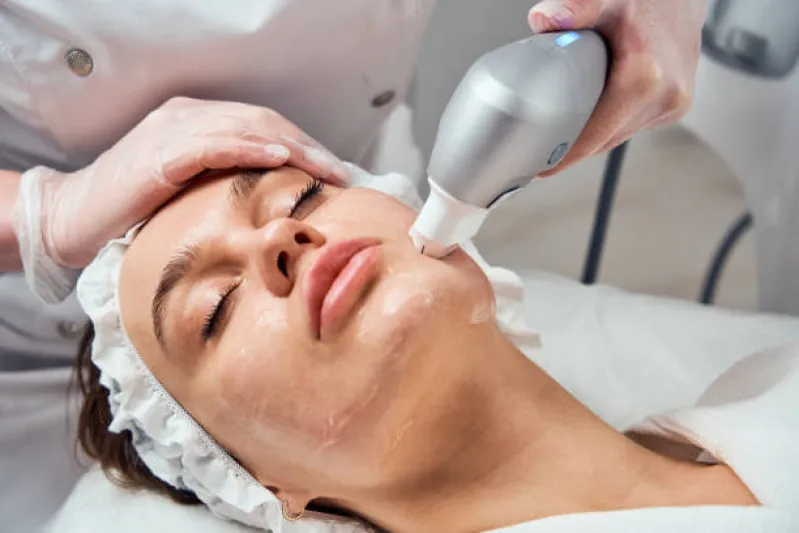 locação máquina de ultrassom microfocado herus mg